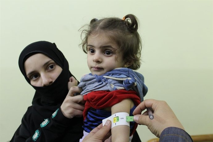Nena amb desnutrició a Ghouta Oriental