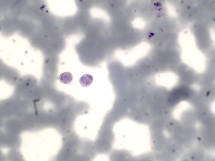 Plasmodium Vivax