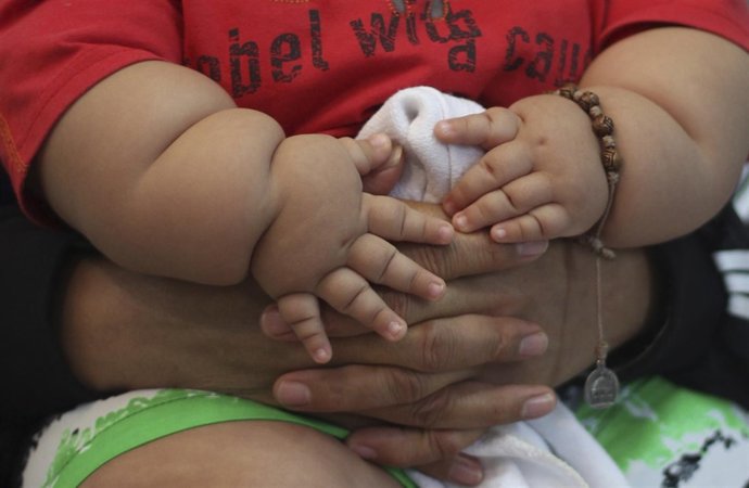 Niño obeso de ocho meses en Bogotá