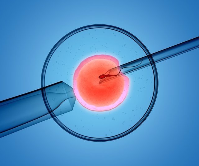 Fecundación in vitro, embrión, óvulo, FIV