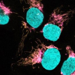 EXD2 amb el ribosoma mitocondrial