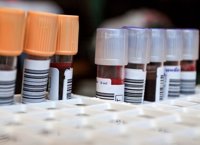Una nueva prueba en sangre permite la detección  de ocho tipos de cáncer