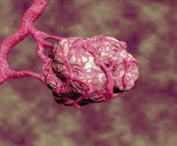 Europa aprueba un biosimilar de 'Avastin' desarrollado por Amgen y Allergan para tratar diferentes tumores