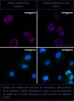 Las células del melanoma son adictas a la proteína LOXL3