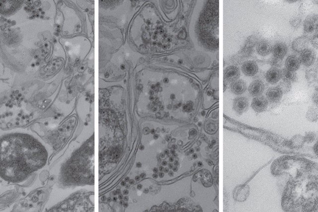 Imagen de bacteria infectada con el nuevo virus