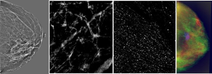 FOTOGRAFÍA DE UNA MAMOGRAFÍA