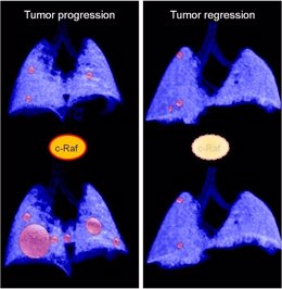 Tumores de pulmón avanzados en modelos de ratón