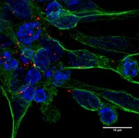 Diseñan una nueva terapia celular para reparar el daño causado por el ictus
