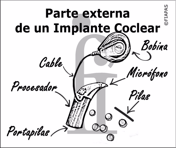 Implante Coclear