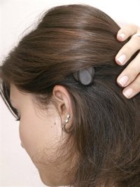 Solo un 10% de los europeos  que podrían volver a oír con un implante coclear se beneficia de esta tecnología