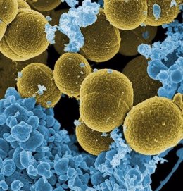 Staphylococcus aureus, bacteria