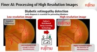 Nueva tecnología para la detección de la retinopatía diabética