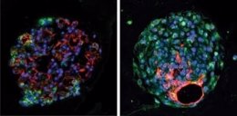 Células madre para regenerar tejido pulmonar