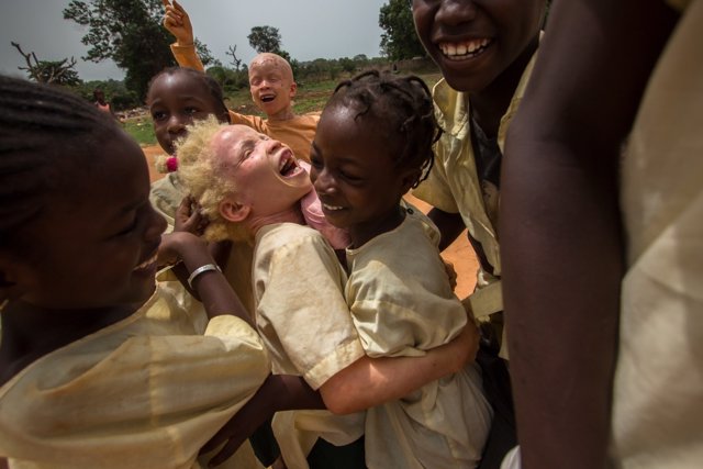 Aicha, una niña con albinismo, juega con sus compañeras de clase