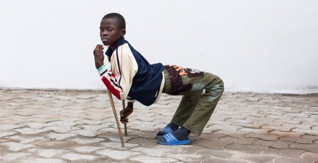 Ulrich, joven camerunés de 15 años al quien llamaban el chico saltamontes