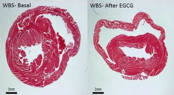 Sección histologia de la pared ventricular de un modelo de WBS