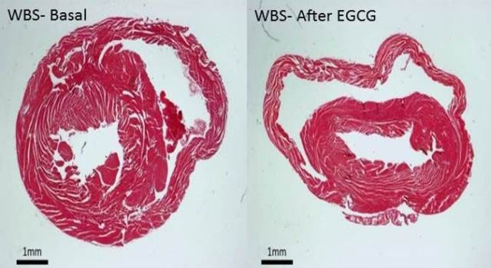 Secció histologia de la paret ventricular d'un model de WBS