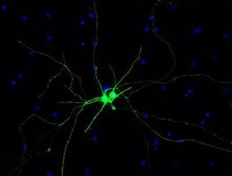 Células ganglionares de la retina derivadas de células madre pluripotentes mm