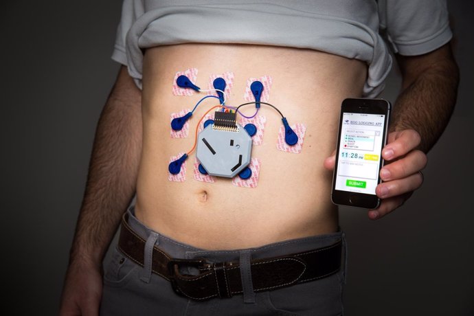 Dispositivo para monitorizar la actividad eléctrica del estómago