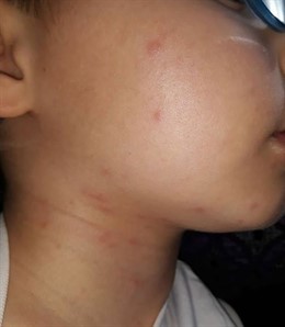 Plaga procesionaria en colegio de Cuenca