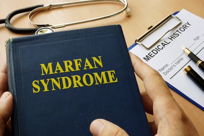 Síndrome de Marfan