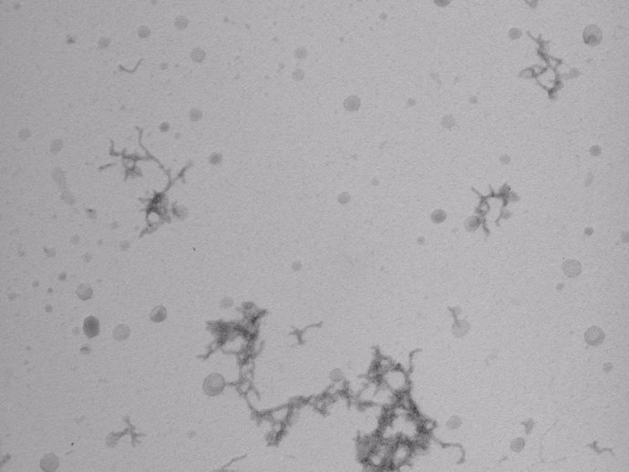 Imagen de microscopia de cúmulos de proteínas beta-amiloide 'in vitro'