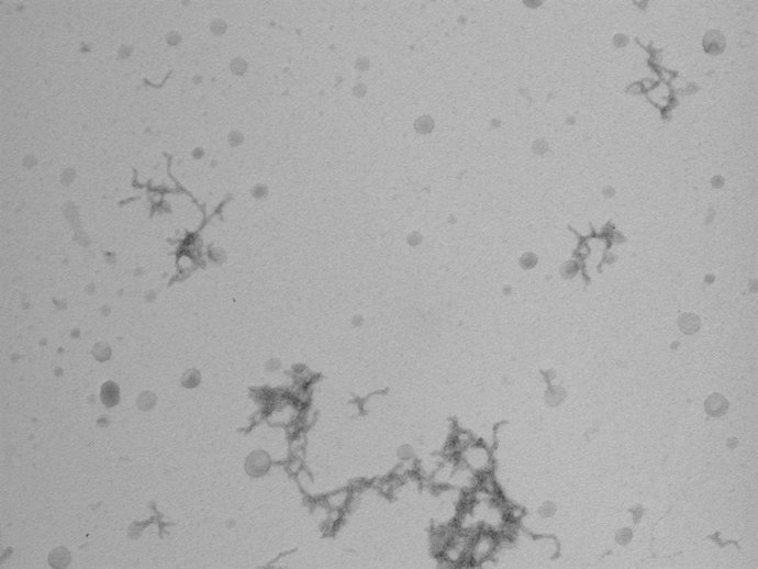 Imatge de microscòpia de cúmuls de proteïnes betaamiloide 'in vitro'