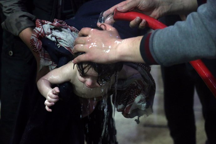 Niño afectado por un supuesto ataque químico en Duma