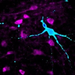 Dos tipos de neuronas hipotalámicas derivadas de iPSC
