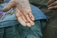 MSF tacha de "inhumano" el "baño de sangre" causado por Israel en Gaza