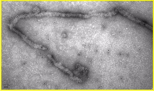 El bote de tipo clínico encontrado el viernes en Palma con la etiqueta 'Filoviriade Ebola Virus ARN' no está infectado