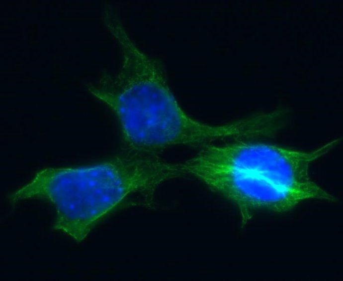Células de cáncer de mama derivadas de un tumor mamario de ratón