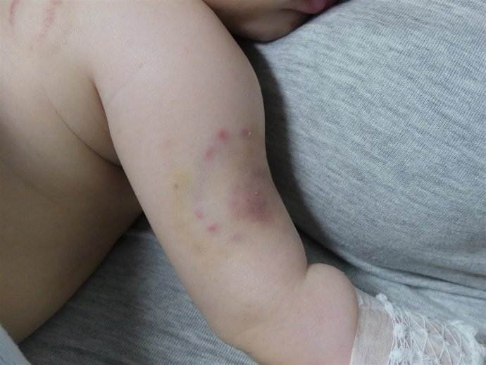 Las lesiones que presentaba el menor