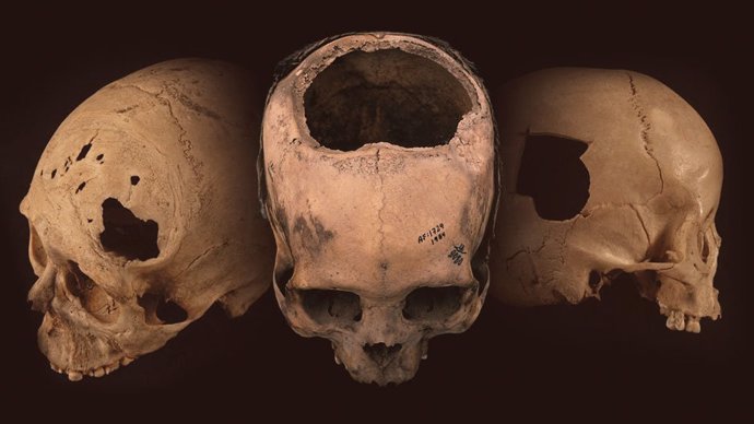 Antiguos cráneos con evidencia de trepanación