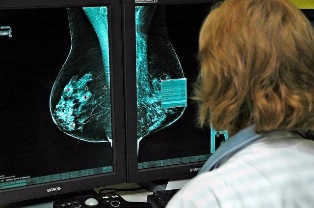 Investigación sobre el cáncer de mama