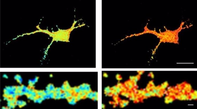 Agregados amiloides alteran la función neuronal en el Alzheimer