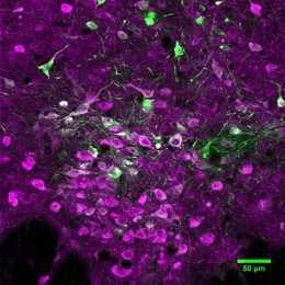 Microfotografía de neuronas productoras de serotonina en el cerebro de ratones