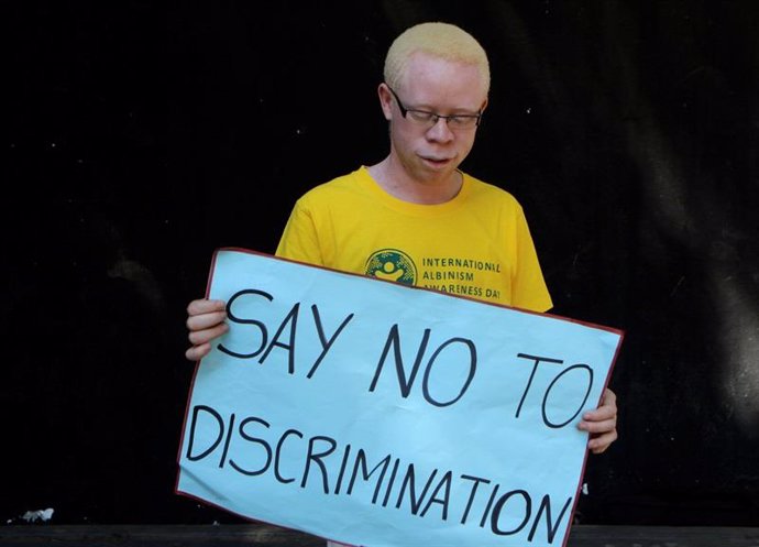 Una persona con albinismo con una pancarta contra la discriminación