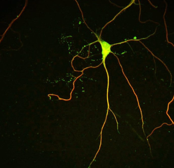 Microtúbulos de una neurona