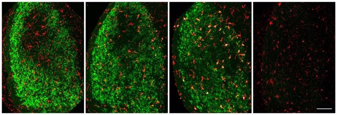 Identifican las neuronas esponsables de eliminar las dañadas en una lesión