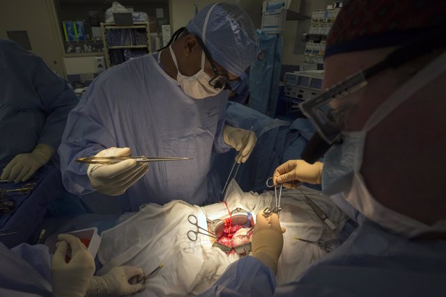 Un trasplante de órgano durante una operación quirúrguica.
