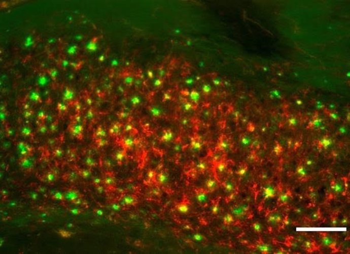 Sección de cerebro de un ratón transgénico para EA mostrando acumulaciones de pl