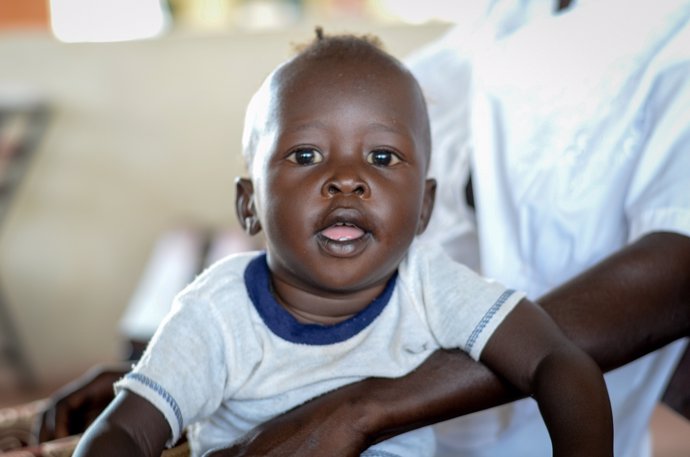 John Jacob, un niño sursudanés que se ha recuperado de desnutrición