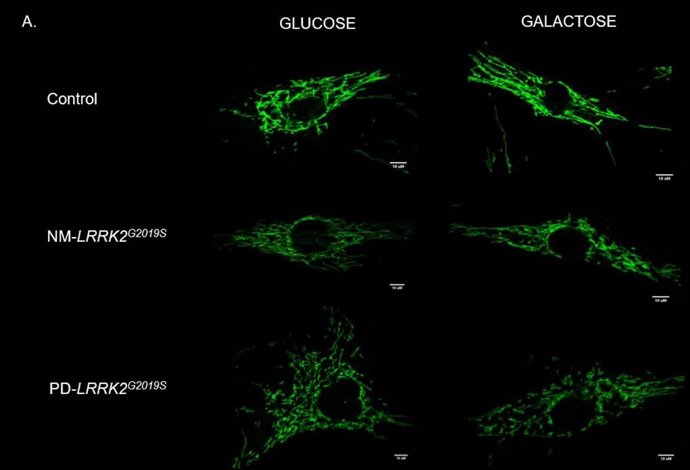Gráfico del reto mitocondrial con Glucosa y Galactosa