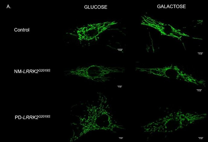 Gràfic del repte mitocondrial amb Glucosa i Galactosa