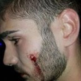 Joven agredido en una discoteca