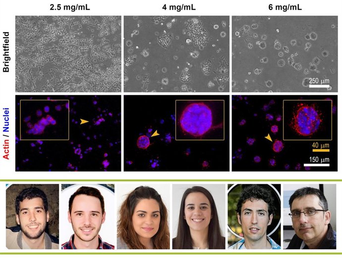 El grupo M2BE del I3A que invetiga sobre el cáncer y la metástasis
