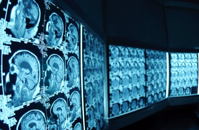 Cerebro, prueba, radiografía 