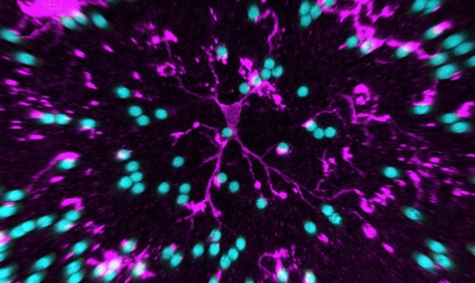 Microglia (pink) are a sort of garbage disposal for the brain. They quickly engu