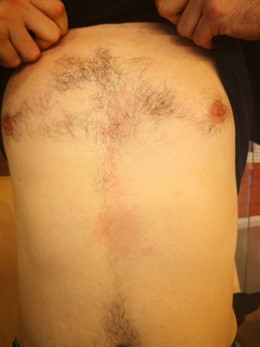 Uno de los agredidos en el Clot